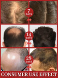 Hair growth essential oil, treatment for hair loss, baldness